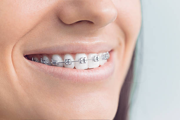 Best Dental Inlays and Onlays  in Woodcliff Lake, NJ